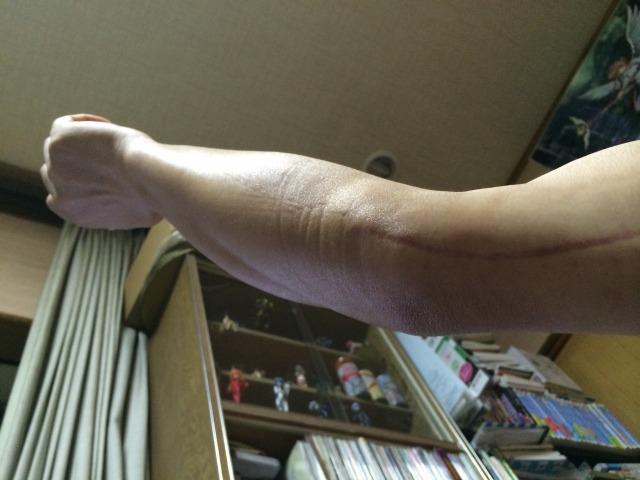 141013肘.jpg